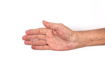 old man's sick hands on white background