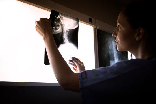 Doctor looking at x-ray image