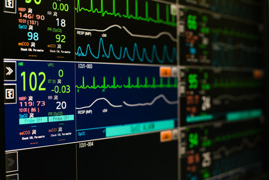 Modern vital signs monitor display at ICU in hospital.