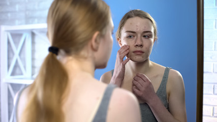Unhappy teenage girl with face acne looking in mirror, hormonal skin problems