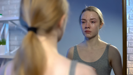 Young female looking at puberty face acne in mirror reflection feeling depressed