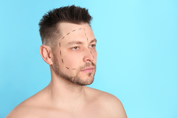 Fototapeta premium Man with marks on face for cosmetic surgery operation against blue background. Space for text