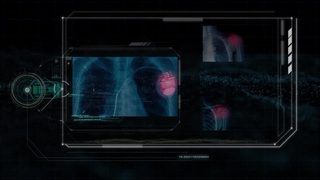 futuristic technology, hologram technology and hi tech monitor on black background, 4K footage medical x-ray image 