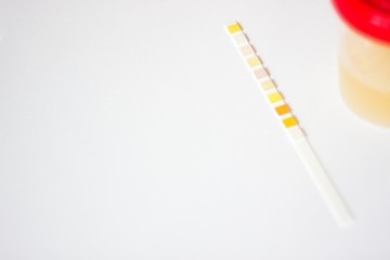 Urine test strip, container, gloves and test chart on white background