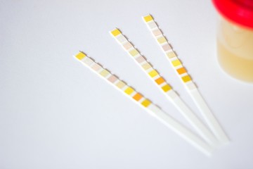 Urine test strip, container, gloves and test chart on white background