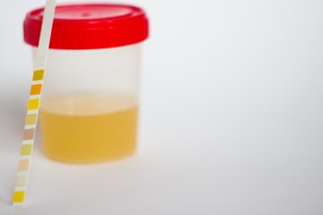 Urine test strip and container on a white background