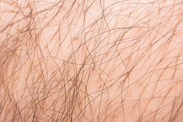 Closeup to hair arm of man