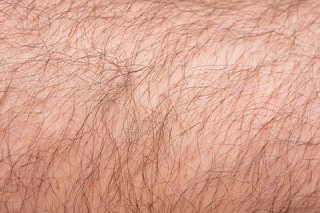 Closeup to hair arm of man