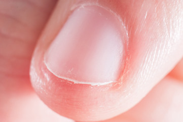 Fototapeta premium Nail on human finger close up, macro