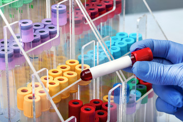 Naklejka premium Doctor holding blood tube sample with white label for study in the blood bank / Hands of a lab technician with a tube of blood sample and in the background a rack with other samples