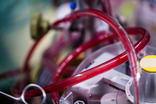 cardiotomy reservoir of oxygenator is a part of heart lung machine.