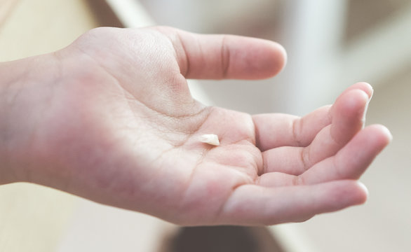 Child holding his fallen milk tooth on his hand.