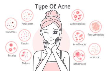 skin care type of acne