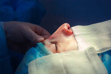 Surgeon and his assistant performing cosmetic surgery on nose in hospital operating room. Nose...