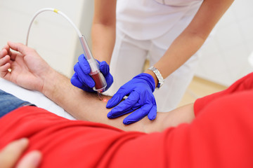Laser cosmetology. The doctor removes pigmentation-moles or warts patient neodymium laser.