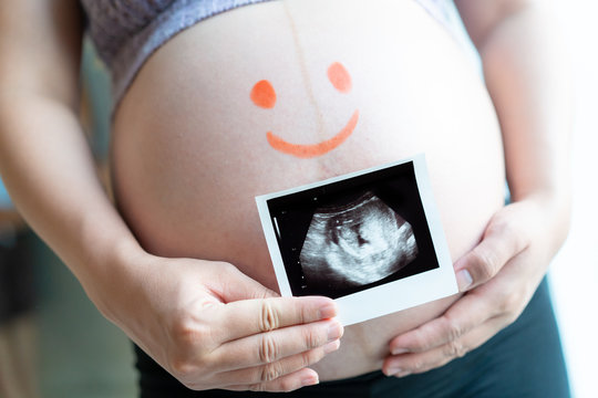 Big belly of pregnant woman holding the ultrasound film on her stomach with drawing kids face.