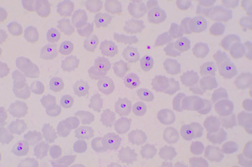 Plasmodium blood parasite ring form stage infected redblood cells