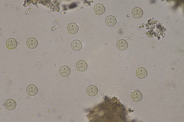 Entamoeba coli cysts stage in stool exam.
