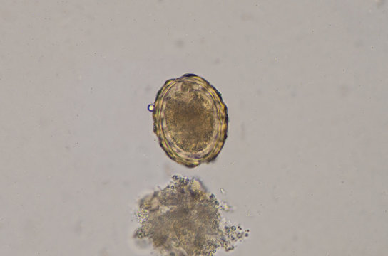 Ascaris lumbricoides egg in stool exam.