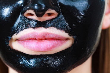 Girl black carbo peel off mask on face