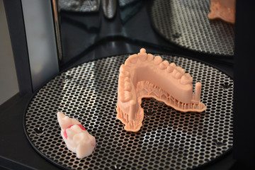 3D Druck Drucker für Dental Modell Mock up im Dentallabor.  Zahnersatz Prothese Zahntechnik Dental...