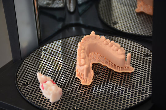 3D Druck Drucker für Dental Modell Mock up im Dentallabor.  Zahnersatz Prothese Zahntechnik Dental Technology.