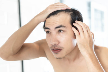 Naklejka premium Close up man looking reflection in the mirror serious hair loss problem for health care shampoo and beauty product concept
