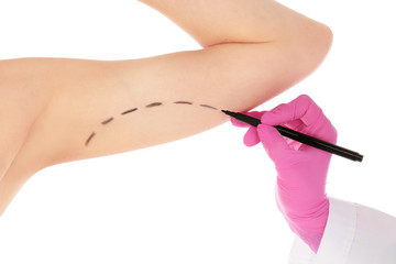 Doctor drawing marks on woman's arm against white background. Cosmetic surgery
