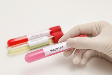 Obraz premium Doctor holding tube with label ALLERGY TEST on light background, closeup