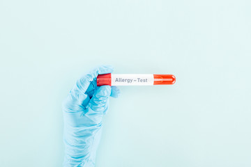 Obraz premium cropped view of doctor in latex glove holding sample with allergy test lettering isolated on blue