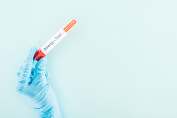 cropped view of doctor holding sample in test tube with allergy test inscription isolated on blue