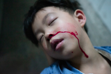 A boy sick, He has nosebleed while sleeping