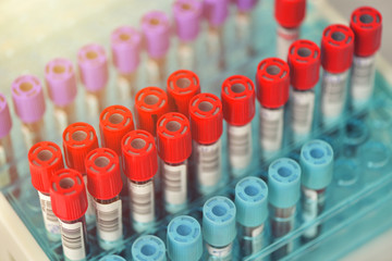 Tubes of blood sample for testing. Medical equipment