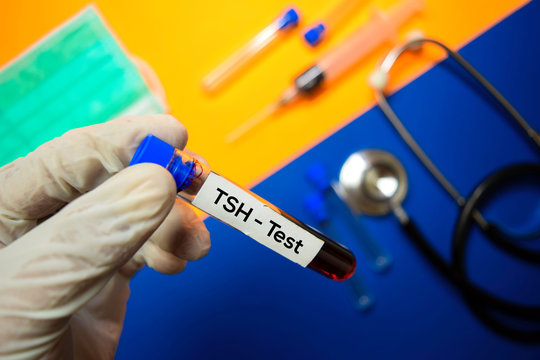 TSH - Test with blood sample. Top view isolated on color background. Healthcare/Medical concept
