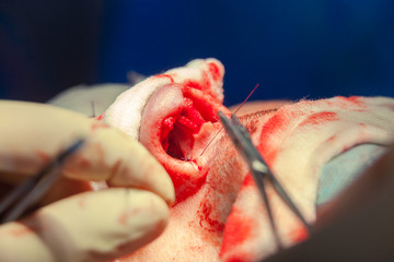 Surgeon and his assistant performing cosmetic surgery on nose in hospital operating room. Nose...
