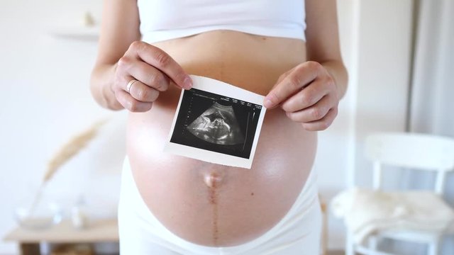 Pregnant Woman Holding Photo Of Her Ultrasound On Her Belly