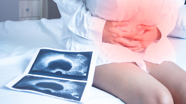 Uterus, ovaries, Ovarian cysts and abnormalities in cells, Close to each other, woman sitting  closed to her stomach because of abdominal pain and a X-ray film.