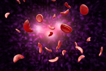 Sickle Cell Anemia 3D Illustration