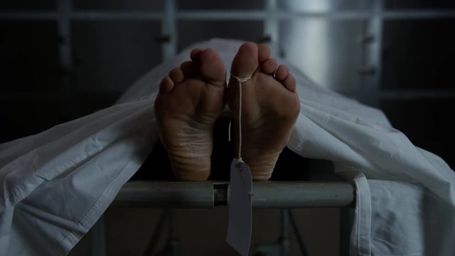 Body on a Gurney in the morgue