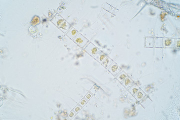 Marine aquatic plankton under microscope view.
