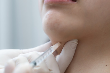 Rejuvenation procedure in beauty clinic injection. Women Injection in her chin..