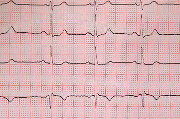 cardiogram close-up on paper front view.