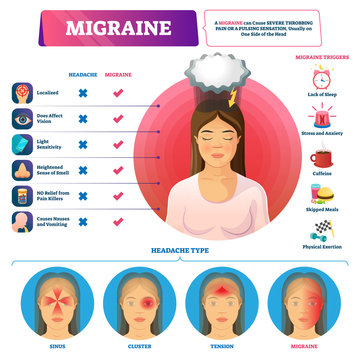 Migraine vector illustration. Labeled headache triggers and types scheme.