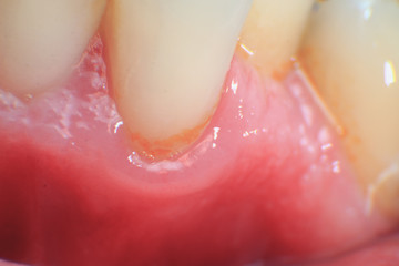 European male crooked yellow teeth super macro
