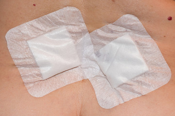 Plaster bandage with absorbent pad