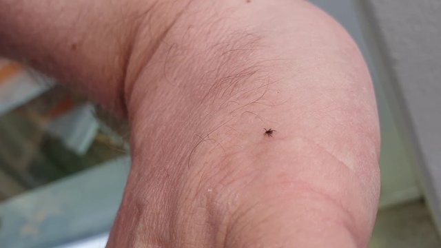 Tick crawling on human skin to find a good place to suck blood