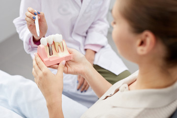 Closeup of unrecognizable female doctor pointing at tooth model while consulting patient, copy space - obrazy, fototapety, plakaty