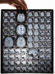 MRI scan image of brain. Holds a picture in his hand
