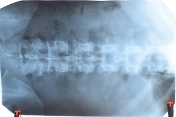 X ray of the lumbar spine, spine on x-ray