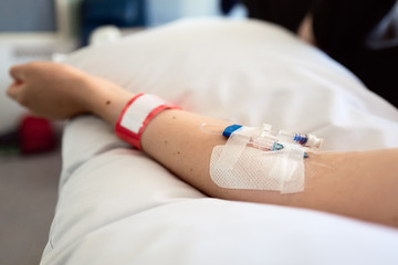 Close up of an IV cannula in the inner elbow of a child